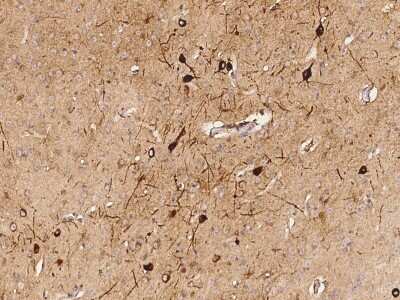 Immunohistochemistry-Paraffin: IL-36Ra/IL-1F5 Antibody [NBP2-98241] - Staining of mouse IL-36Ra/IL-1F5 in mouse brain with rabbit polyclonal antibody (1:1000).