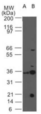 Western Blot: IL-3R alpha/CD123 Antibody (18N6B12) - Azide and BSA Free [NBP2-80811] - Analysis of CD123 in the A) presence and B) absence of equal amounts antibody and immunizing peptide in human SKNSH cell lysate using CD123 antibody at 10 ug/ml. Image from the standard format of this antibody.