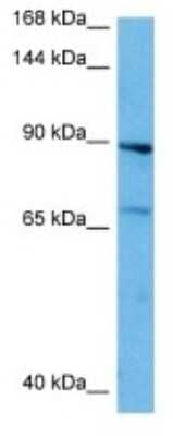 Western Blot: IL-3R beta Antibody [NBP3-10030] - Western blot analysis of IL-3R beta in Human HepG2 Whole Cell lysates. Antibody dilution at 1ug/ml