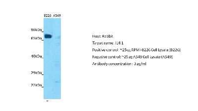 Western Blot: IL-4I1 Antibody [NBP2-84089] - Host: Rabbit. Target: IL4I1. Positive control (+): RPMI-8226 (N12). Negative control (-): A549 (N03). Antibody concentration: 3ug/ml