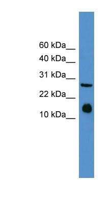 Western Blot: IL-5 Antibody [NBP1-69163] -  Mouse Spleen lysate, concentration 0.2-1 ug/ml.