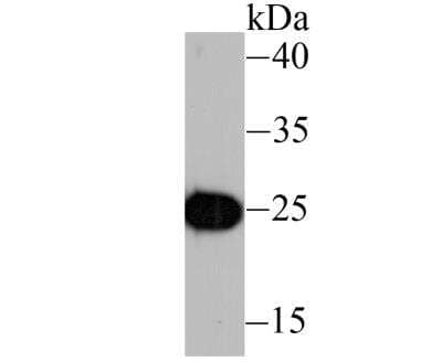 Western Blot: IL-6 Antibody (1-6) [NBP2-89149] - Analysis of IL6 on recombinant protein lysate using anti-IL6 antibody at 1/1,000 dilution.