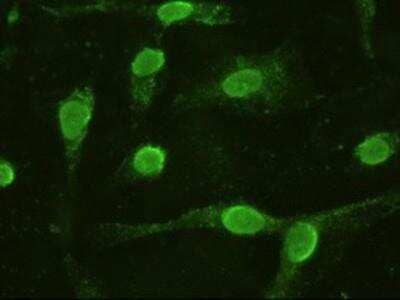 Immunocytochemistry/Immunofluorescence: IL-6 Antibody (3G9) [NBP1-47810] - Staining of COS7 cells transiently transfected by pCMV6-ENTRY IL6.