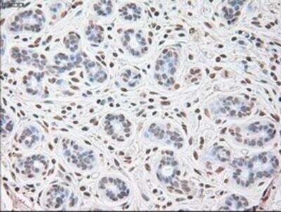 Immunohistochemistry-Paraffin: IL-6 Antibody (3G9) [NBP1-47810] - Staining of paraffin-embedded Human breast tissue using anti-IL6 mouse monoclonal antibody.