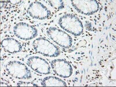 Immunohistochemistry-Paraffin: IL-6 Antibody (3G9) [NBP1-47810] -  Staining of paraffin-embedded Human colon tissue using anti-IL6 mouse monoclonal antibody.