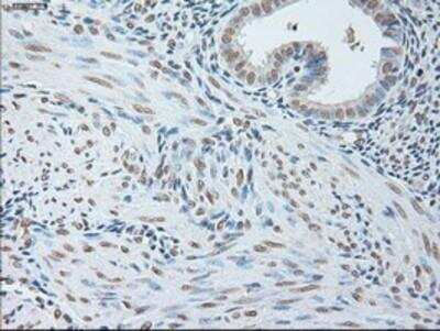 Immunohistochemistry-Paraffin: IL-6 Antibody (3G9) [NBP1-47810] -  Staining of paraffin-embedded Human endometrium tissue using anti-IL6 mouse monoclonal antibody.