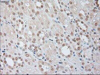 Immunohistochemistry-Paraffin: IL-6 Antibody (3G9) [NBP1-47810] - Staining of paraffin-embedded Human Kidney tissue using anti-IL6 mouse monoclonal antibody.