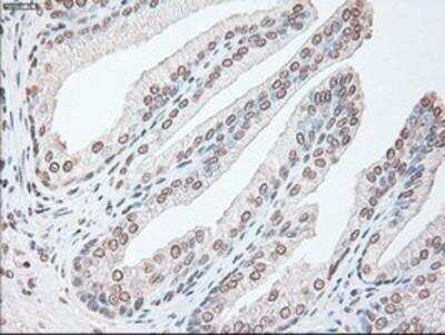 Immunohistochemistry-Paraffin: IL-6 Antibody (3G9) [NBP1-47810] -  Staining of paraffin-embedded Human prostate tissue using anti-IL6 mouse monoclonal antibody.