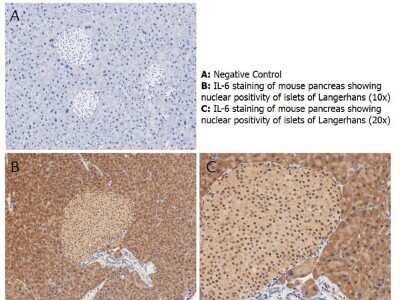 Immunohistochemistry: IL-6 Antibody [NBP1-77894] - Shows nuclear positivity of islets of Langerhans (brown staining) and cytoplasmic staining in mouse pancreas at 10x and 20x (B & C). Staining was performed on Leica Bond system using the standard protocol. Formalin fixed/paraffin embedded tissue sections were subjected to antigen retrieval with E1 (Leica Microsystems) retrieval solution for 20 min and then incubated with rabbit anti-mouse IL-6 antibody at 1:50 dilution for 60 minutes. Biotinylated Anti-rabbit secondary antibody was used at 1:200 dilution to detect primary antibody. The reaction was developed using streptavidin-HRP conjugated compact polymer system and visualized with chromogen substrate, 3’3-diamino-benzidine substrate (DAB). The sections were then counterstained with hematoxylin to detect cell nuclei.