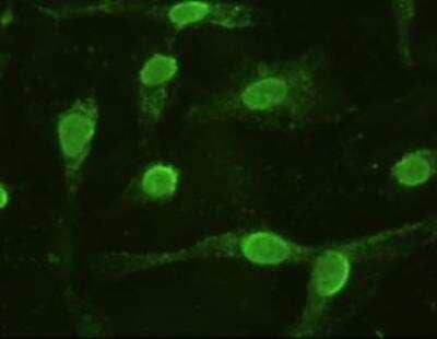 Immunocytochemistry/Immunofluorescence: IL-6 Antibody (OTI3G9) - Azide and BSA Free [NBP2-71027] - Anti-IL-6 mouse monoclonal antibody immunofluorescent staining of COS7 cells transiently transfected by pCMV6-ENTRY IL-6.