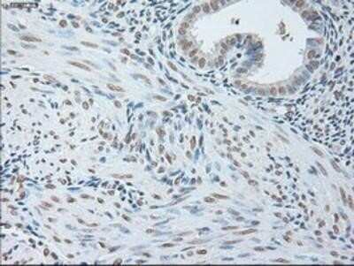 Immunocytochemistry/Immunofluorescence: IL-6 Antibody (OTI3G9) - Azide and BSA Free [NBP2-71027] - Staining of paraffin-embedded Human endometrium tissue using anti-IL6 mouse monoclonal antibody.