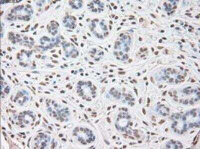 Immunohistochemistry-Paraffin: IL-6 Antibody (OTI3G9) - Azide and BSA Free [NBP2-71027] - Staining of Human breast tissue within the normal limits using anti-IL-6 mouse monoclonal antibody. (Heat-induced epitope retrieval by 10mM citric buffer, pH6.0, 100 degrees C for 10min.