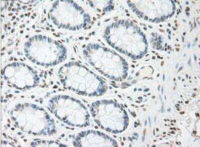 Immunohistochemistry-Paraffin: IL-6 Antibody (OTI3G9) - Azide and BSA Free [NBP2-71027] - Staining of  Human colon tissue within the normal limits using anti-IL-6 mouse monoclonal antibody. (Heat-induced epitope retrieval by 10mM citric buffer, pH6.0, 100 degrees C for 10min.