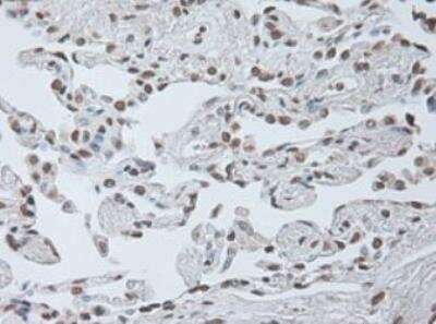 Immunohistochemistry-Paraffin: IL-6 Antibody (OTI3G9) - Azide and BSA Free [NBP2-71027] - Staining of Human lung tissue within the normal limits using anti-IL-6 mouse monoclonal antibody. (Heat-induced epitope retrieval by 10mM citric buffer, pH6.0, 100 degrees C for 10min.