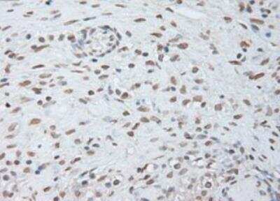 Immunohistochemistry-Paraffin: IL-6 Antibody (OTI3G9) - Azide and BSA Free [NBP2-71027] - Staining of Human Ovary tissue within the normal limits using anti-IL-6 mouse monoclonal antibody. (Heat-induced epitope retrieval by 10mM citric buffer, pH6.0, 100 degrees C for 10min.