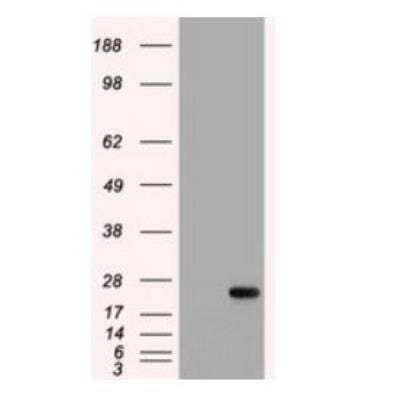 Western Blot: IL-6 Antibody (OTI3G9) - Azide and BSA Free [NBP2-71027] - HEK293T cells were transfected with the pCMV6-ENTRY control (Left lane) or pCMV6-ENTRY IL-6 ( Right lane) cDNA for 48 hrs and lysed. Equivalent amounts of cell lysates (5 ug per lane) were separated by SDS-PAGE and immunoblotted with anti-IL-6. Positive lysates LY424617 (100ug) and LC424617 (20ug).