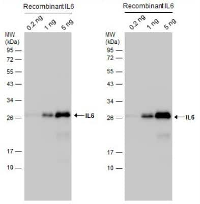 <b>Independent Antibodies Validation and Biological Strategies Validation.</b>Western Blot: IL-6 Antibody [NBP2-16957] - IL6 antibody detects IL6 recombinant protein by western blot analysis. Various amounts of protein were separated by 12% SDS-PAGE, and the membranes were blotted with IL6 antibody.