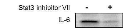 <b>Biological Strategies Validation. </b>Western Blot: IL-6 Antibody [NBP2-16957] - Human breast cancer cell line MDA-MB-231 was treated by Stat3 inhibitor and expression of IL-6 was detected by Western blot. Image from verified customer review.