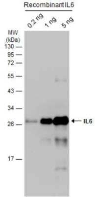 Western Blot: IL-6 Antibody [NBP2-16957] - Recombinant IL6 were separated by 12% SDS-PAGE, and the membrane was blotted with IL6 antibody diluted at 1:2000. The HRP-conjugated anti-rabbit IgG antibody (NBP2-19301) was used to detect the primary antibody.