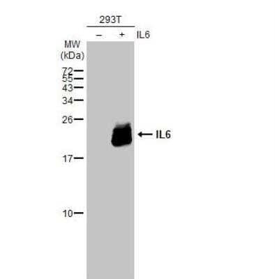 Western Blot: IL-6 Antibody [NBP2-16957] - on-transfected (-) and transfected (+) 293T whole cell extracts (30 ug) were separated by 12% SDS-PAGE, and the membrane was blotted with IL6 antibody  diluted at 1:1500. The HRP-conjugated anti-rabbit IgG antibody (NBP2-19301) was used to detect the primary antibody.