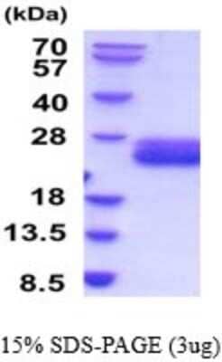 SDS-Page: Recombinant Mouse IL-6 Protein [NBP2-52156] - 15% SDS Page (3 ug)