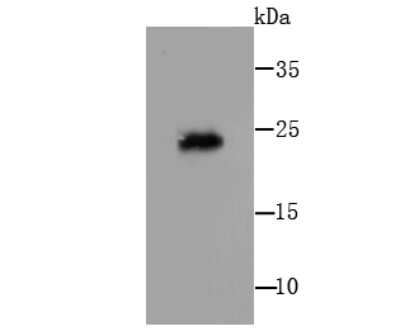 Western Blot: IL-7 Antibody (AH34-12) [NBP2-67277] - Analysis of IL7 on human thymus cell lysates using anti- IL7 antibody at 1/500 dilution.