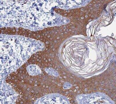 Immunohistochemistry-Paraffin: IL-7 Antibody [NBP1-83111] - Staining of human skin shows strong cytoplasmic and membranous positivity in squamous epithelial cells.