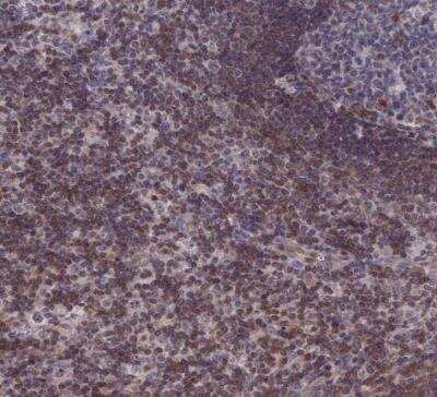 Immunohistochemistry-Paraffin: IL-7 Antibody [NBP1-83111] - Staining of human lymph node shows moderate cytoplasmic and membranous positivity in non-germinal center cells.