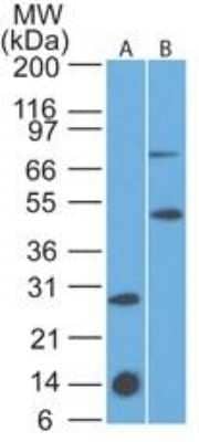 Western Blot: IL-7 R alpha/CD127 Antibody (73N8F2) - Azide Free [NBP2-25264] - Western blot analysis of A) IL-17R recombinant protein fragment and B) mouse thymus lysate using this antibody at 2 ug/ml.