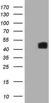 Western Blot: IL12B Antibody (OTI1A3) - Azide and BSA Free [NBP2-71032] - Analysis of HEK293T cells were transfected with the pCMV6-ENTRY control (Left lane) or pCMV6-ENTRY IL12B.