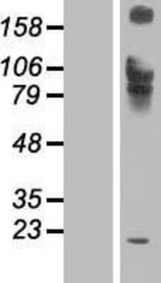 Western Blot: IL12RB1 Overexpression Lysate (Adult Normal) [NBP2-07735] Left-Empty vector transfected control cell lysate (HEK293 cell lysate); Right -Over-expression Lysate for IL12RB1.