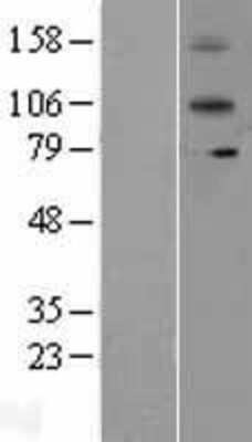 Western Blot: IL12RB2 Overexpression Lysate (Adult Normal) [NBL1-11903] Left-Empty vector transfected control cell lysate (HEK293 cell lysate); Right -Over-expression Lysate for IL12RB2.