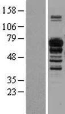 Western Blot: IL16 Overexpression Lysate (Adult Normal) [NBL1-11911] Left-Empty vector transfected control cell lysate (HEK293 cell lysate); Right -Over-expression Lysate for IL16.
