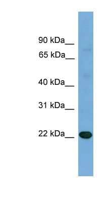 Western Blot: IL17D Antibody [NBP1-79686] - Titration: 0.2-1 ug/ml, Positive Control: Human Placenta.