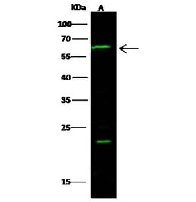 Western Blot: IL18R1 Antibody [NBP2-98456] - Anti-IL18R1 rabbit polyclonal antibody at 1:500 dilution. Lane A: A549 Whole Cell Lysate. Lysates/proteins at 30 ug per lane. Secondary Goat Anti-Rabbit IgG H&L (Dylight 800) at 1/10000 dilution. Developed using the Odyssey technique. Performed under reducing conditions. Predicted band size: 62 kDa. Observed band size: 62 kDa (We are unsure as to the identity of these extra bands).