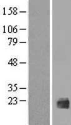 Western Blot: IL1F10 Overexpression Lysate (Adult Normal) [NBP2-05156] Left-Empty vector transfected control cell lysate (HEK293 cell lysate); Right -Over-expression Lysate for IL1F10.