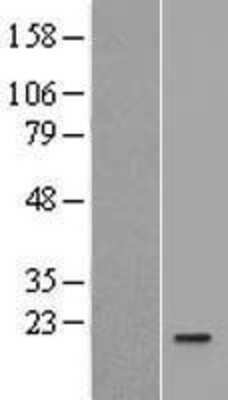 Western Blot IL-36Ra/IL-1F5 Overexpression Lysate