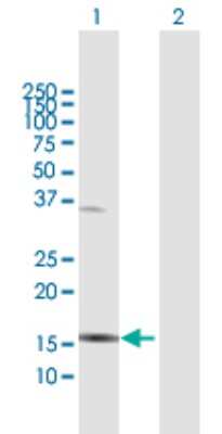 Western Blot: IL1F6 Antibody [H00027179-B01P] - Analysis of IL1F6 expression in transfected 293T cell line by IL1F6 polyclonal antibody.  Lane 1: IL1F6 transfected lysate(17.38 KDa). Lane 2: Non-transfected lysate.