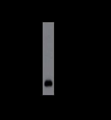Western Blot: IL1F8 Antibody (MM0387-2Q27) [NBP2-11687]