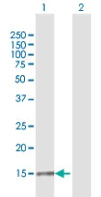 Western Blot: IL1F8 Antibody [H00027177-B01P] - Analysis of IL1F8 expression in transfected 293T cell line by IL1F8 polyclonal antibody.  Lane1:IL1F8 transfected lysate(17.27 KDa). Lane2:Non-transfected lysate.