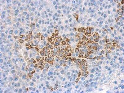 Immunohistochemistry-Paraffin: IL1F9 Antibody [NBP1-31185] - Paraffin-embedded hela xenograft, using antibody at 1:500 dilution.