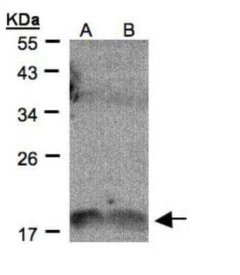Western Blot: IL1F9 Antibody [NBP1-31185] - Sample(30 ug of whole cell lysate)  A:H1299 B:HeLa S312% SDS PAGE  diluted at 1:500