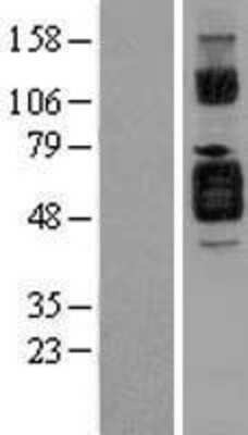 Western Blot IL-1 RII Overexpression Lysate