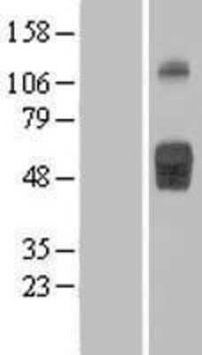 Western Blot IL-1 RII Overexpression Lysate