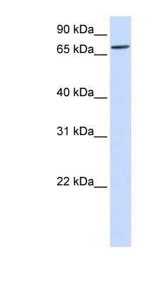 Western Blot: IL1RAPL2 Antibody [NBP1-62241] - Human Liver cell lysate, concentration 0.2-1 ug/ml.