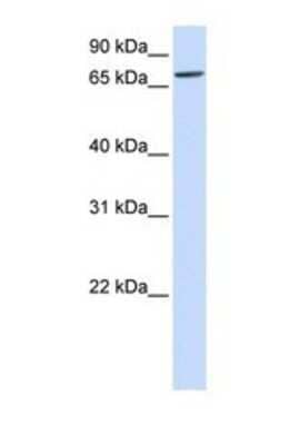 Western Blot: IL1RAPL2 Antibody [NBP1-69275] - This Anti-IL1RAPL2 antibody was used in Western Blot of Fetal Liver tissue lysate at a concentration of 1ug/ml.