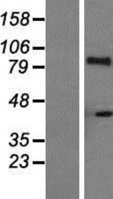 Western Blot: IL21 Receptor Overexpression Lysate (Adult Normal) [NBP2-04935] Left-Empty vector transfected control cell lysate (HEK293 cell lysate); Right -Over-expression Lysate for IL21 Receptor.