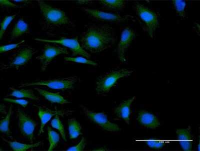 Immunocytochemistry/Immunofluorescence: IL25 Antibody [H00056005-B01P] - Analysis of purified antibody to C19orf10 on HeLa cell. (antibody concentration 10 ug/ml)