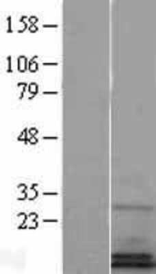 Western Blot: SF20/MYDGF Overexpression Lysate [NBP2-04376] - Left-Empty vector transfected control cell lysate (HEK293 cell lysate); Right -Over-expression Lysate for SF20/MYDGF.