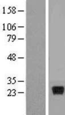 Western Blot: IL28A Overexpression Lysate (Adult Normal) [NBP2-05197] Left-Empty vector transfected control cell lysate (HEK293 cell lysate); Right -Over-expression Lysate for IL28A.